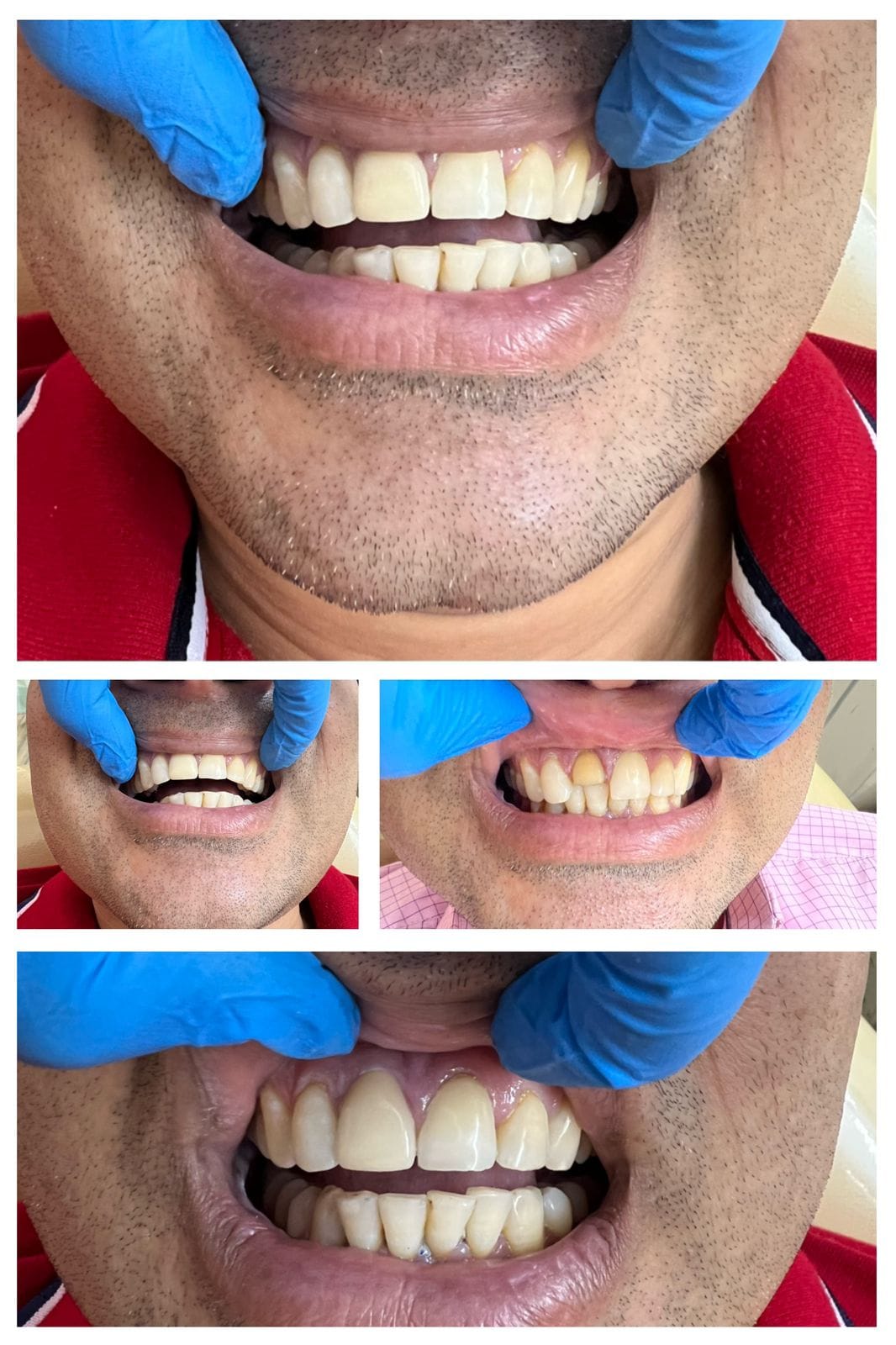 aesthetic dentistry