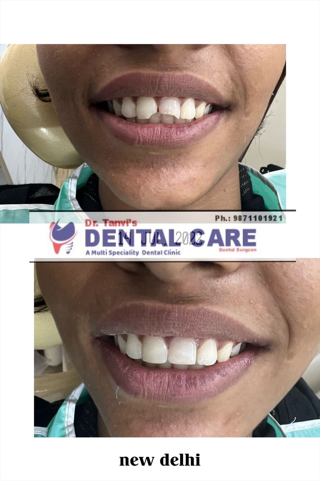 aesthetic dentistry